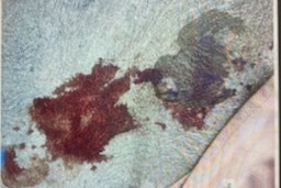 Bloodstains on pavement.