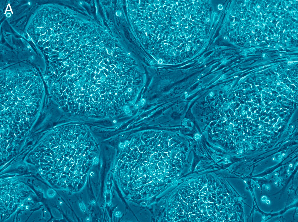 cover of episode The conundrum of unused IVF embryos: The Trouble With Embryos Part 2