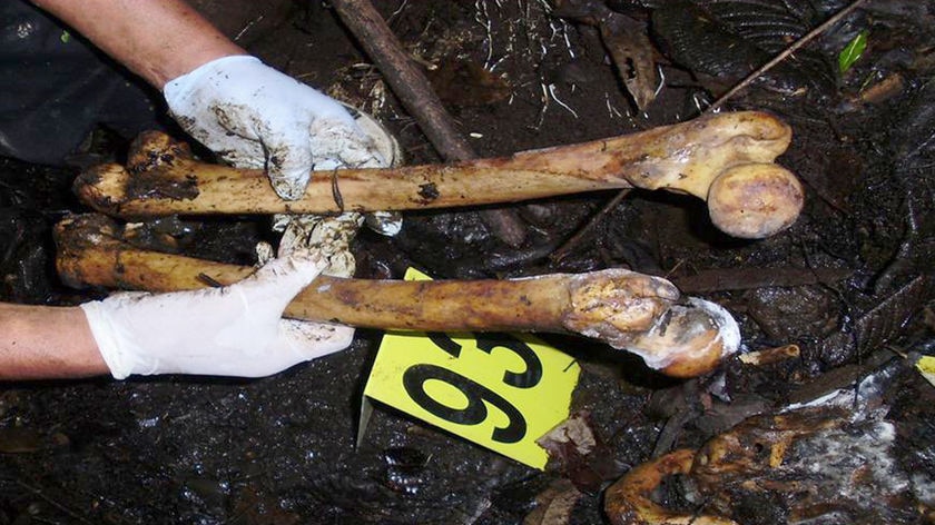 A forensic scientist displays human bones