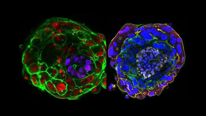 Images of human embryo at day 10 and day 11