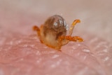 Close-up of a larval tick feeding from the thin skin on an adult man's ankle.