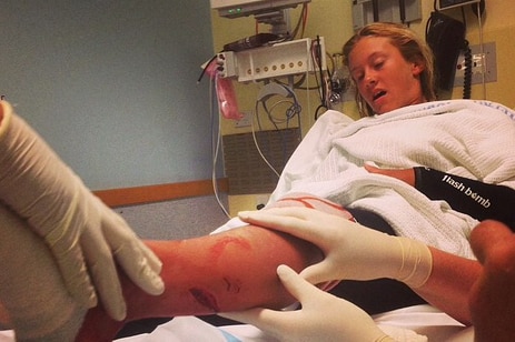 Kirra-Belle Olsson is treated by doctors after she was attacked by a shark at Avoca Beach