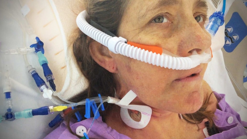 Woman in hospital bed with tubes in her nose and neck.