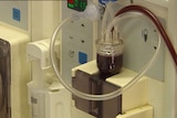 kidney machine