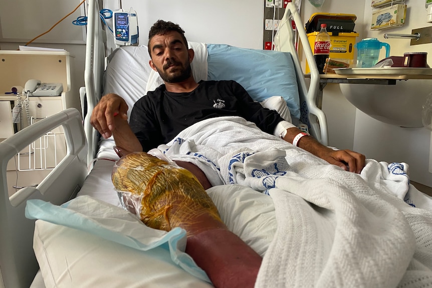A young Indigenous man lying in hospital with his leg covered in surgical tape.