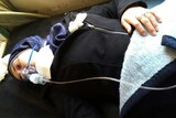 Aya Fadl, lies on a bed, with an oxygen mask to heal breathing difficulties following a suspected chemical attack.