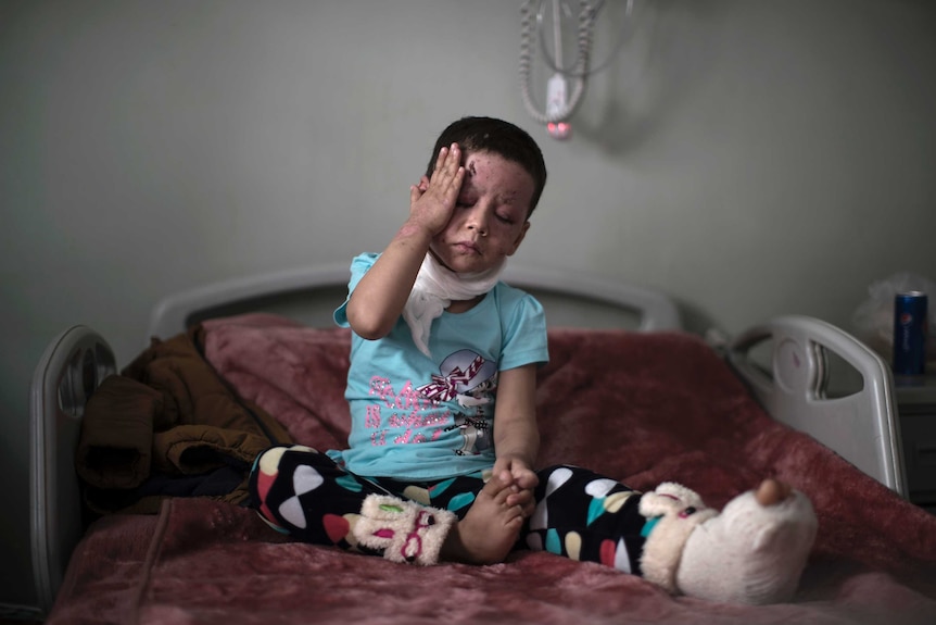 Hawra Alaa Hassan, 4-years–old, who was badly burned in a US airstrike in Mosul, sits on her bed at a hospital in Irbil, Iraq.
