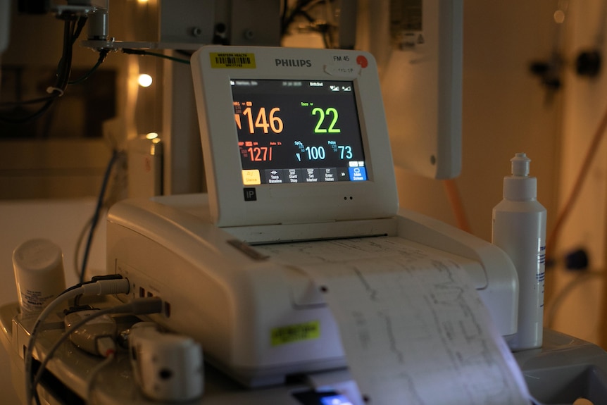 A CTG machine feeds out paper and displays the vitals of a woman in labour.