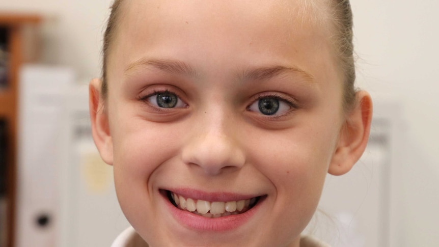 Close up of Hayley Moore who has a prosthetic eye.