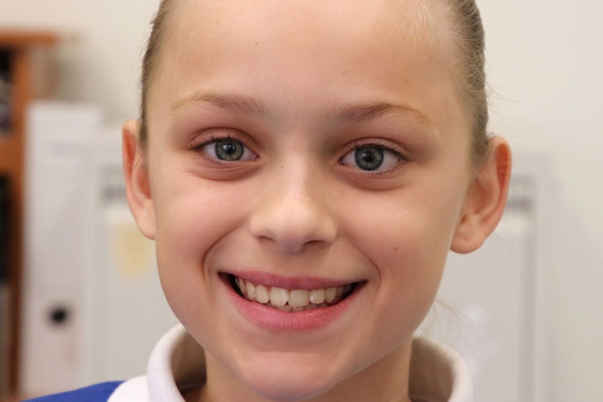 Close up of Hayley Moore who has a prosthetic eye.