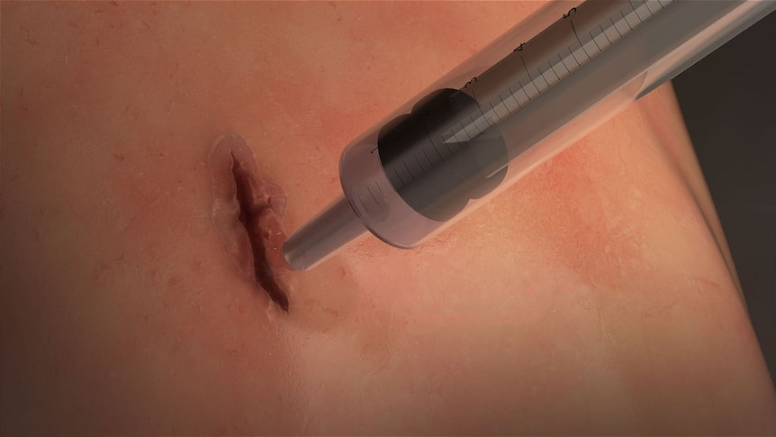 A graphic showing a syringe applying gel to a wound.