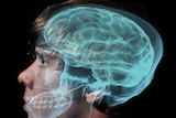 A profile shot of a young man, with an xray of his brain