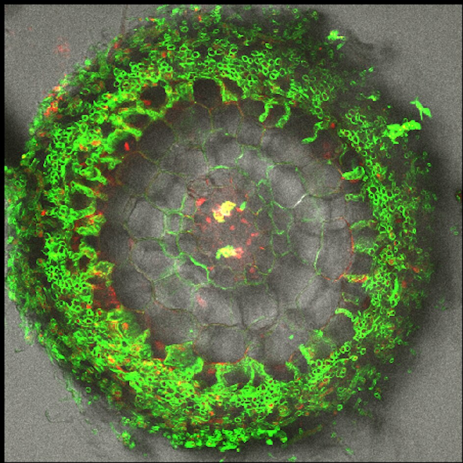 A microscopy image of a tree root with fungus stained green