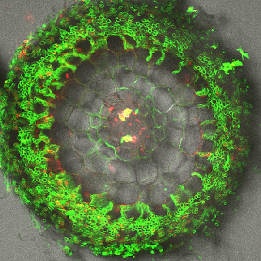 A microscopy image of a tree root with fungus stained green