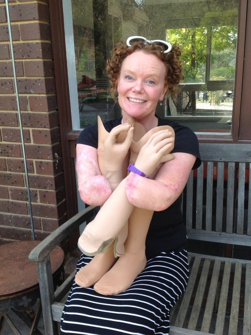 Mandy McCracken holding her prosthetic limbs in story about parenting with a disability