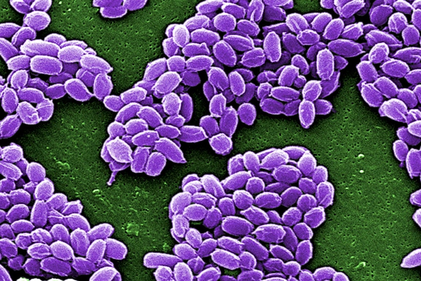 Spores from the Sterne strain of anthrax bacteria