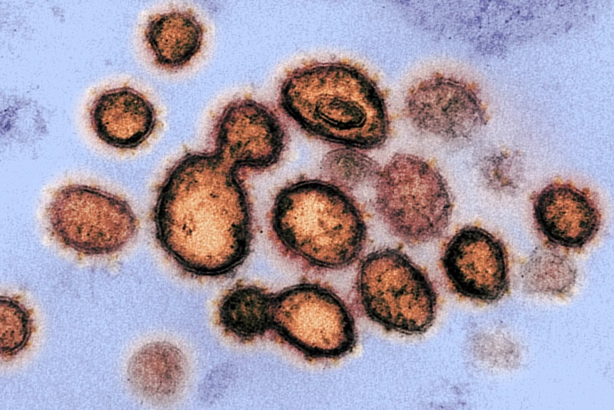 A transmission electron microscope image of SARS-CoV-2, the virus that causes COVID-19.