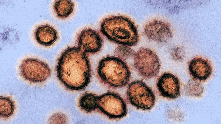 A transmission electron microscope image of SARS-CoV-2, the virus that causes COVID-19.