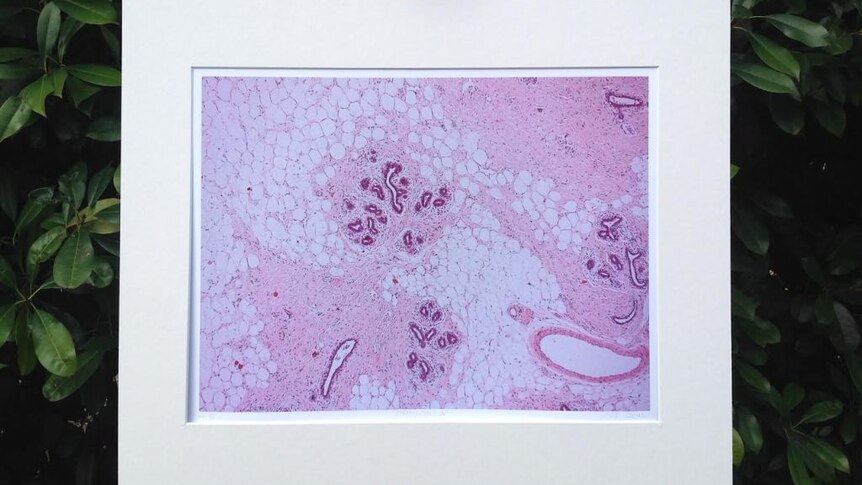 Healthy breast cell print