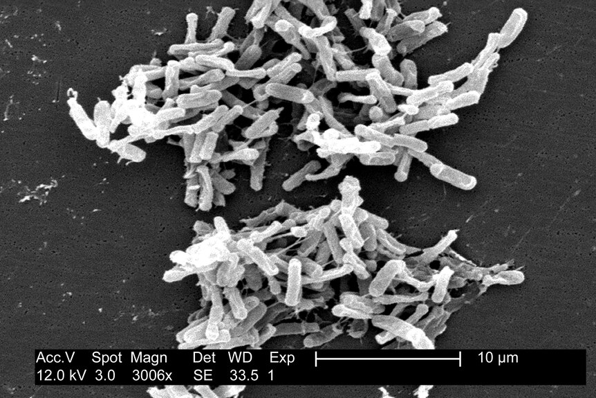 A black and white image of lots of rod shaped bacteria