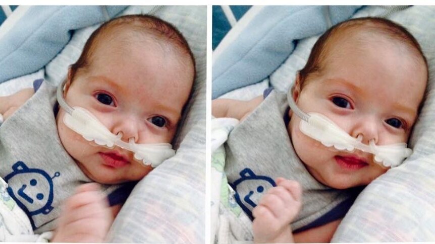 Four photos of a young baby with breathing tubes, smiling