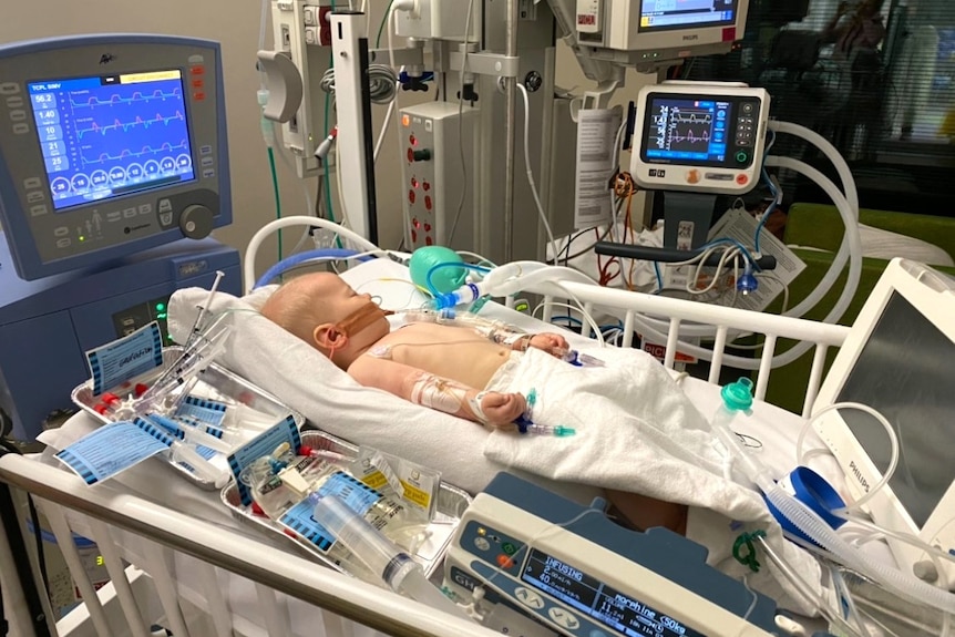 A baby in a hospital bed with several medical tubes connected to them 