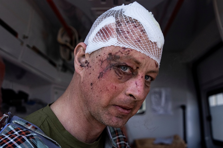 A man with dried blood on his face and bandages on his head.