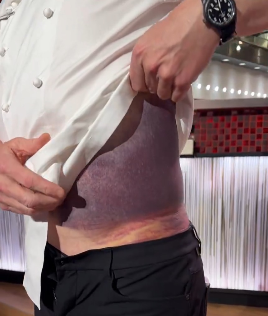 MasterChef star Gordon Ramsay escapes major injury after cycling crash ...