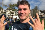 South Sydney rugby league player Angus Crichton shows off his amputated finger