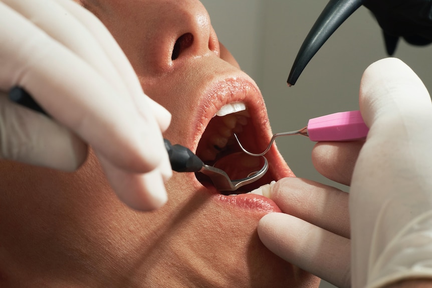 A dentist is working on a patient's teeth