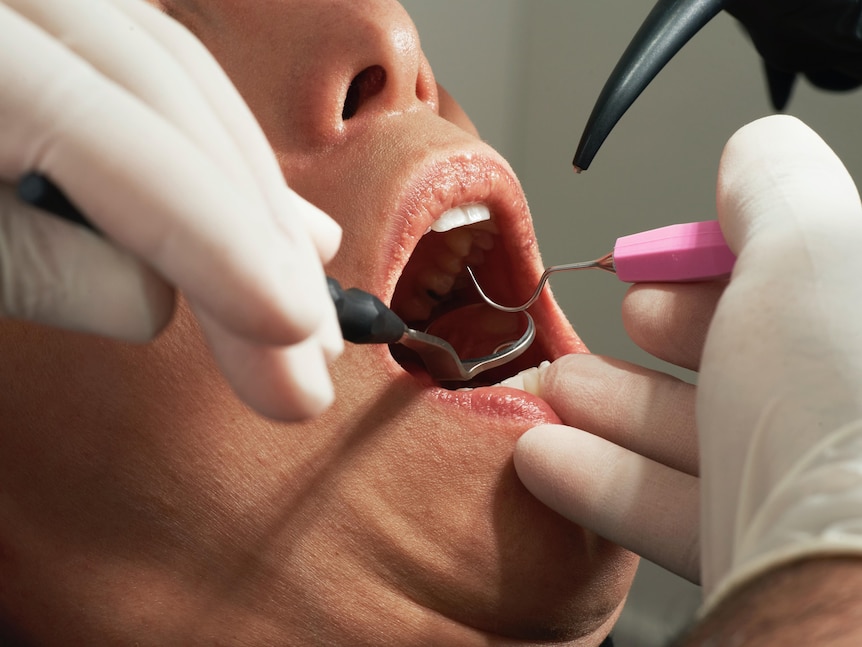 A dentist is working on a patient's teeth