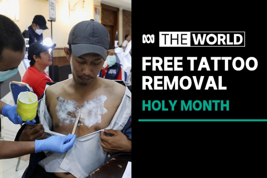 Free Tattoo Removal, Holy Month: A man in a surgical mask applies a white substance to man's bare chest.