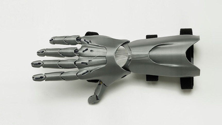 A 3D printed prosthetic hand.