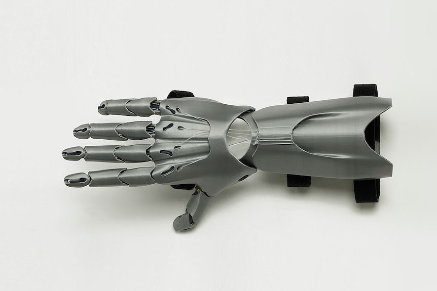 A 3D printed prosthetic hand.