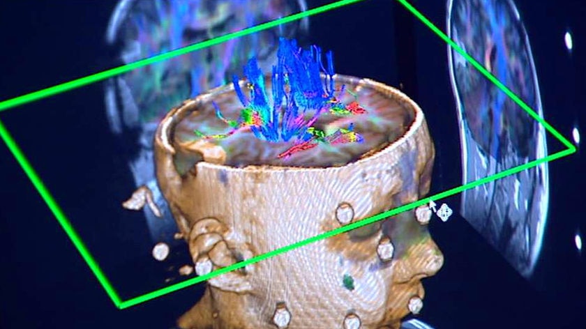 A brain scan used during an operation.