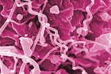Syphilis bacteria