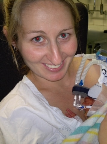 A woman in hospital with a premature baby resting on her shoulder.