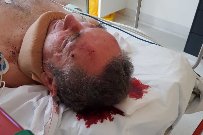 Jim Dodrill in hospital being treated after bashing on June 25.