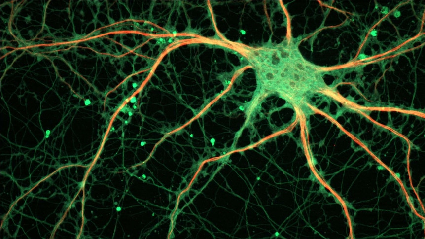 A hippocampal neuron.
