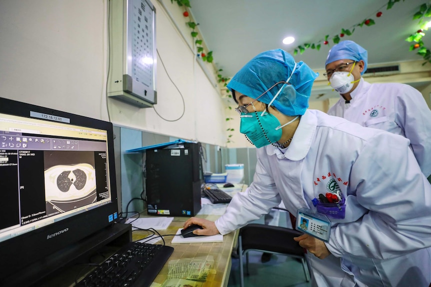 Doctors look at a CT scan of a patient at a hospital in Wuhan in central China's Hubei Province, Thursday, Jan. 30, 2020.