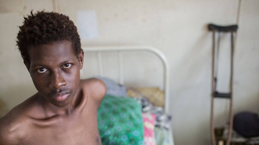 Tuberculosis patient in Daru hospital in PNG