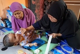 Two women leaning over an infant with a suction tube near his face.