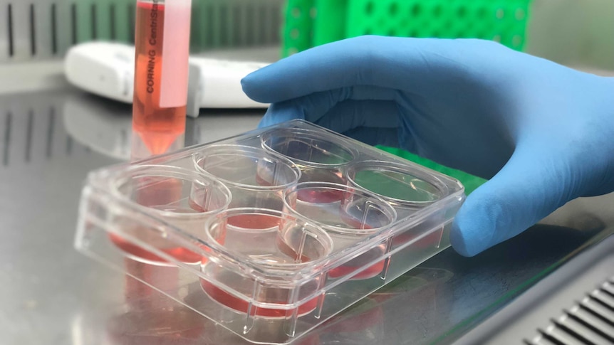Le sang de veau fœtal atteint un record de 615 $ le litre alors que les laboratoires de recherche obtiennent un produit crucial