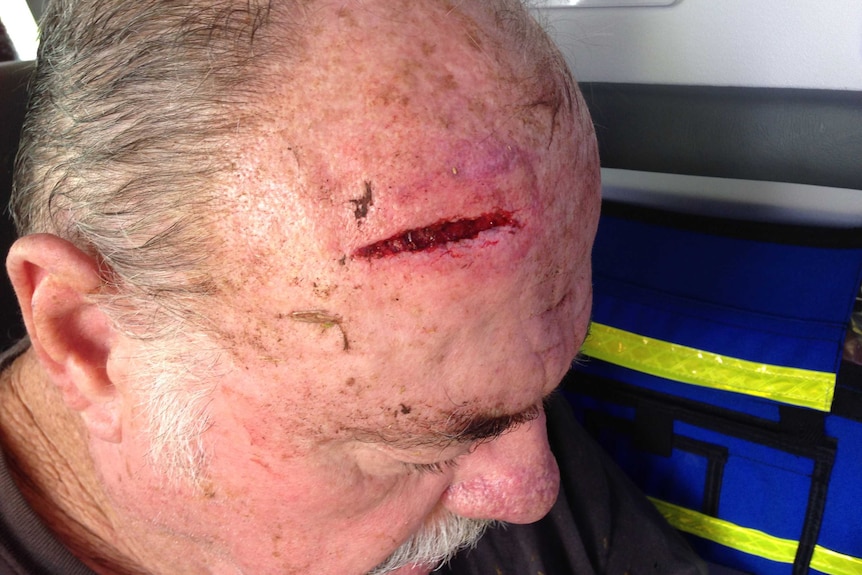 Far north Qld MP Warren Entsch nursing a sore head after being rammed by his cow on November 21, 2015