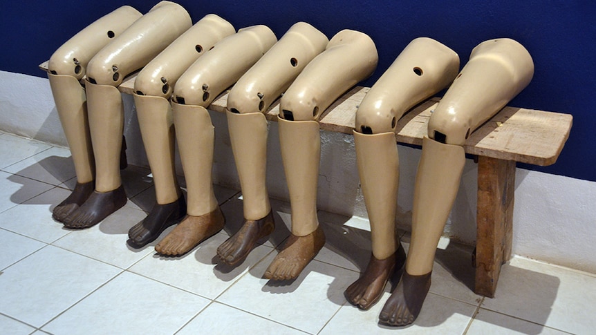Prosthetic legs lined up against a wall.