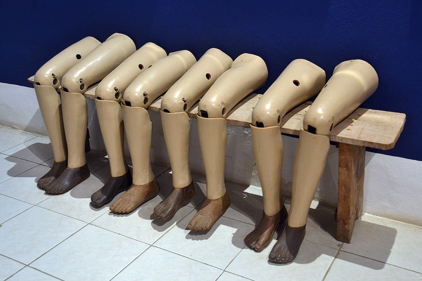 Prosthetic legs lined up against a wall.