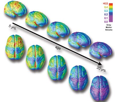 Teen Alcohol And Brain Development