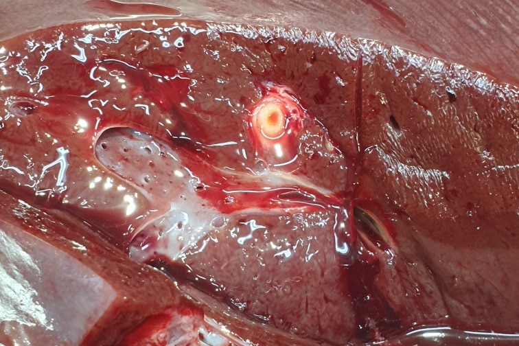 Damage to a bovine liver from liver fluke.