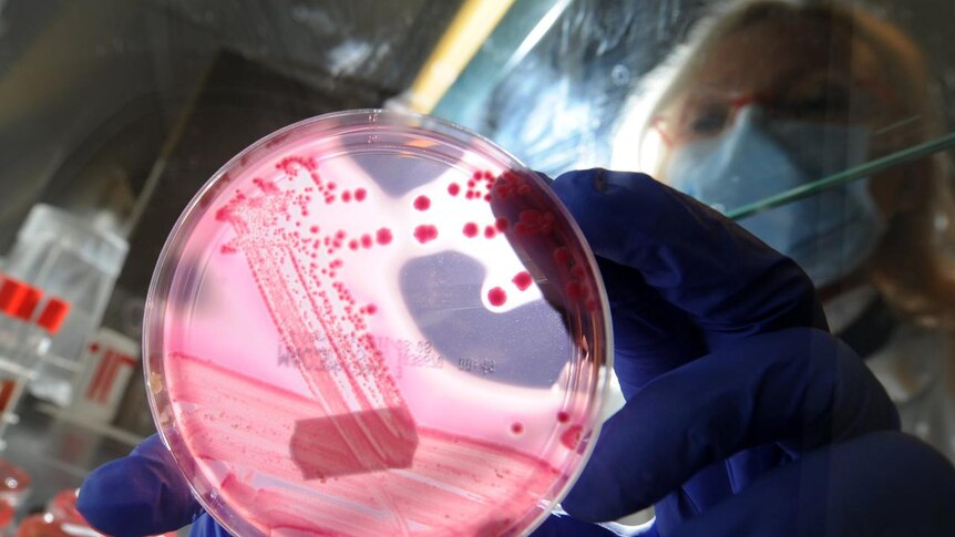 A hospital worker in Hamburg holds up a petri dish containing the bacterial strains of E.coli