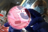 A hospital worker in Hamburg holds up a petri dish containing the bacterial strains of E.coli